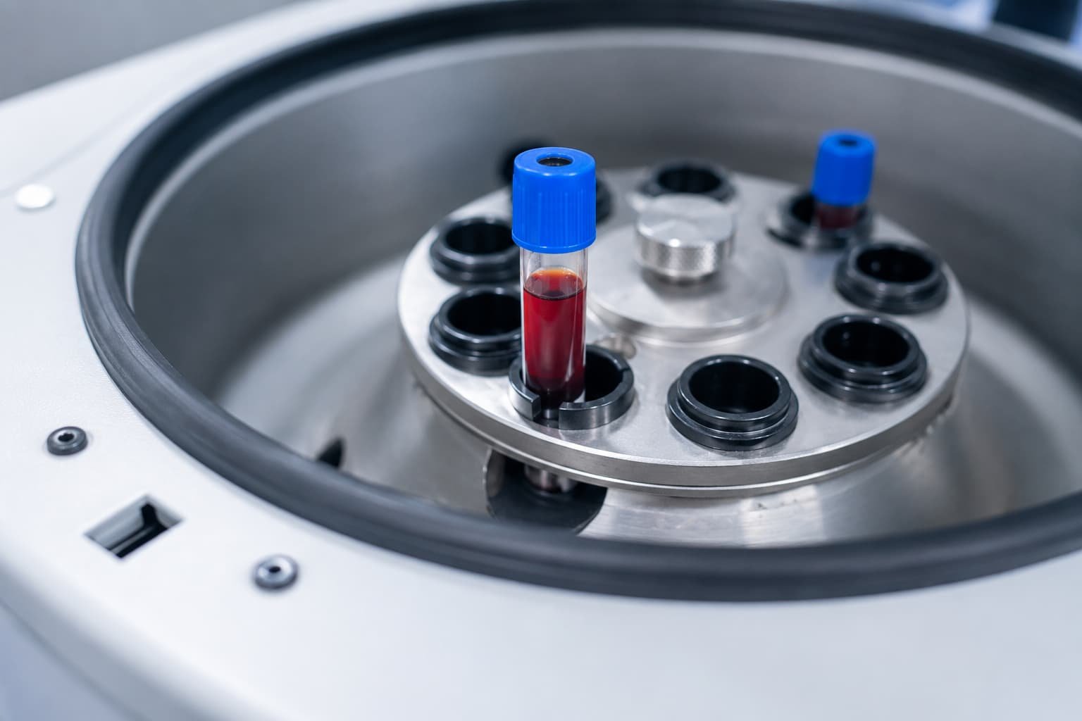 Centrifuge separating platelet-rich plasma from a blood sample.