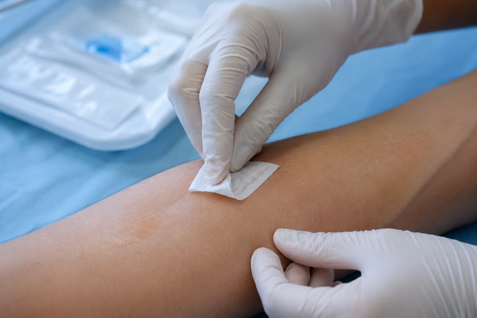 Clinician applying antiseptic skin preparation before a P Shot injection
