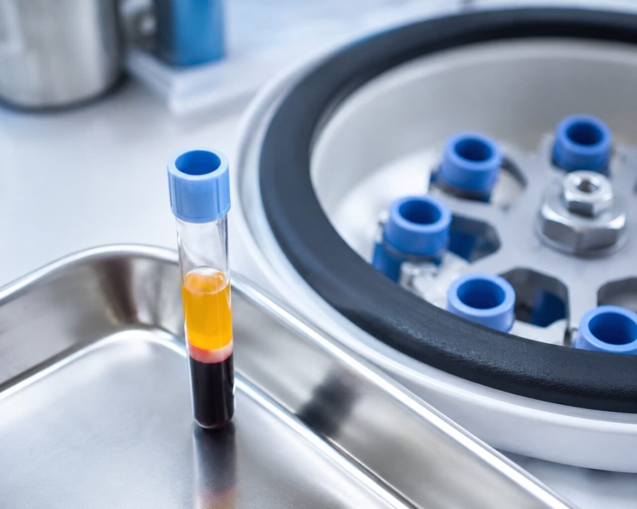 Centrifuge separating platelet-rich plasma used in P Shot treatment
