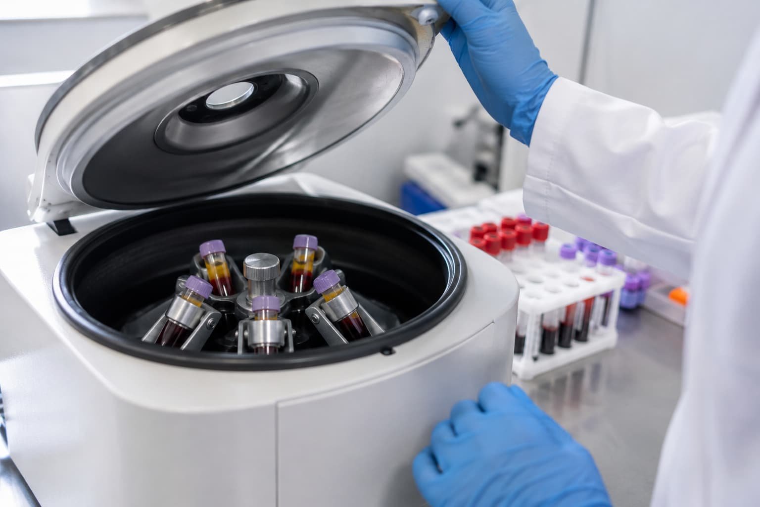 Medical-grade centrifuge preparing platelet-rich plasma for P shot treatment