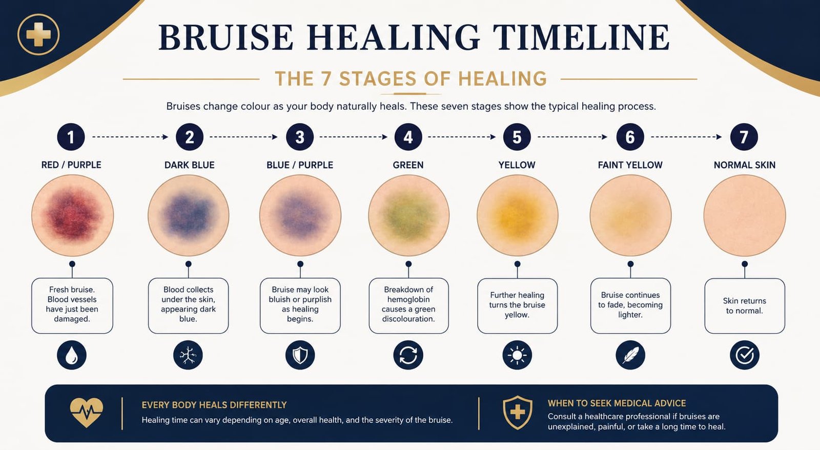 P Shot bruising healing timeline and colour stages