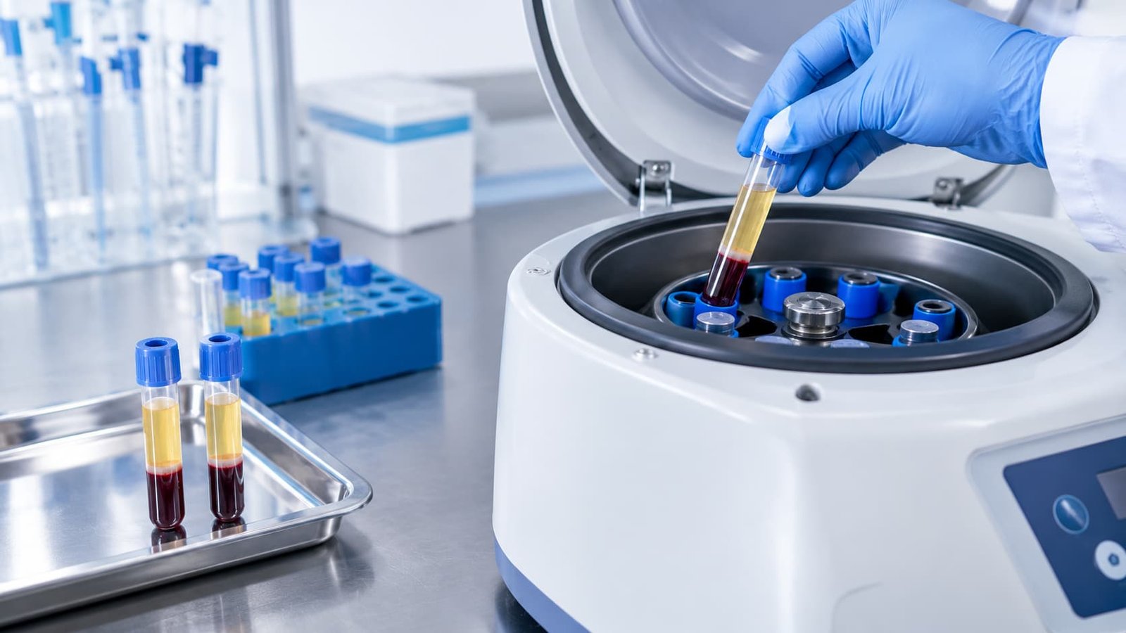 Centrifuge and blood tubes separating platelet-rich plasma for PRP therapy